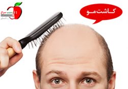 آیا روش کاشت مو برای همه افراد یکسان است؟